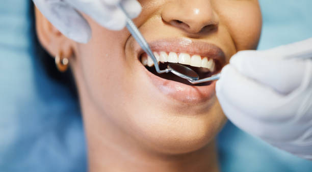 Best Emergency Dentist for Knocked-Out Tooth in St James, MO